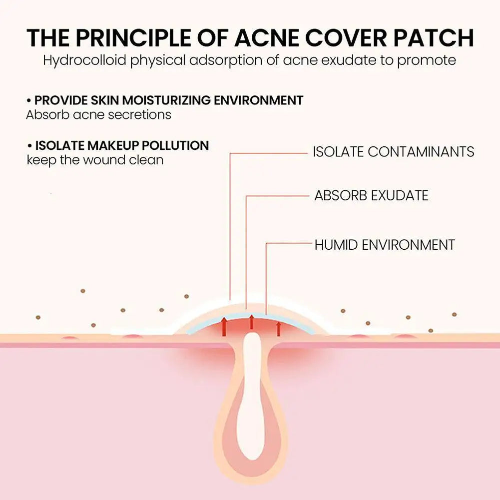 200Pcs/Set Star Shape Pimple Patches Colorful Hydrocolloid Pimple Healing Sticker Cute Strong Absorption Zit Patches Face Care